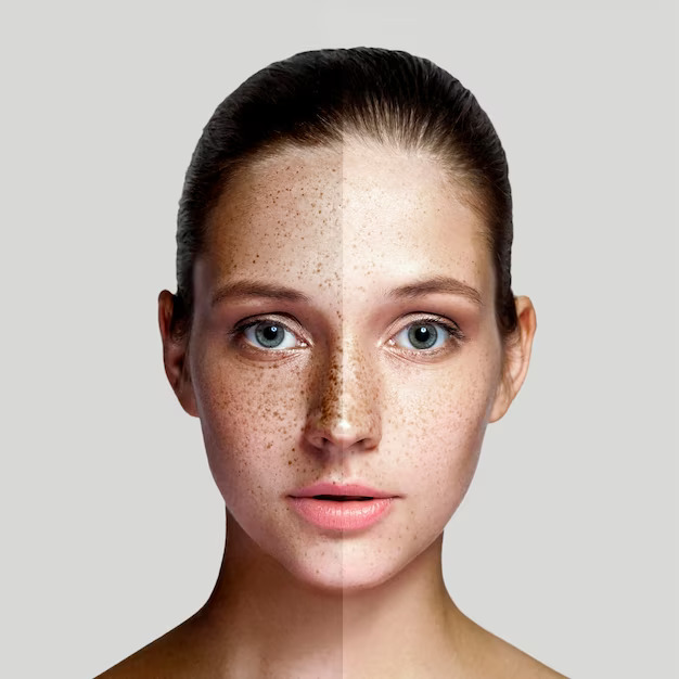 skin-pigmentation